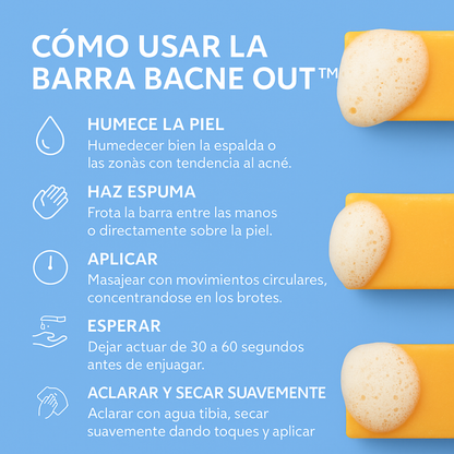 Bacne - Elimina tu acné de la espalda