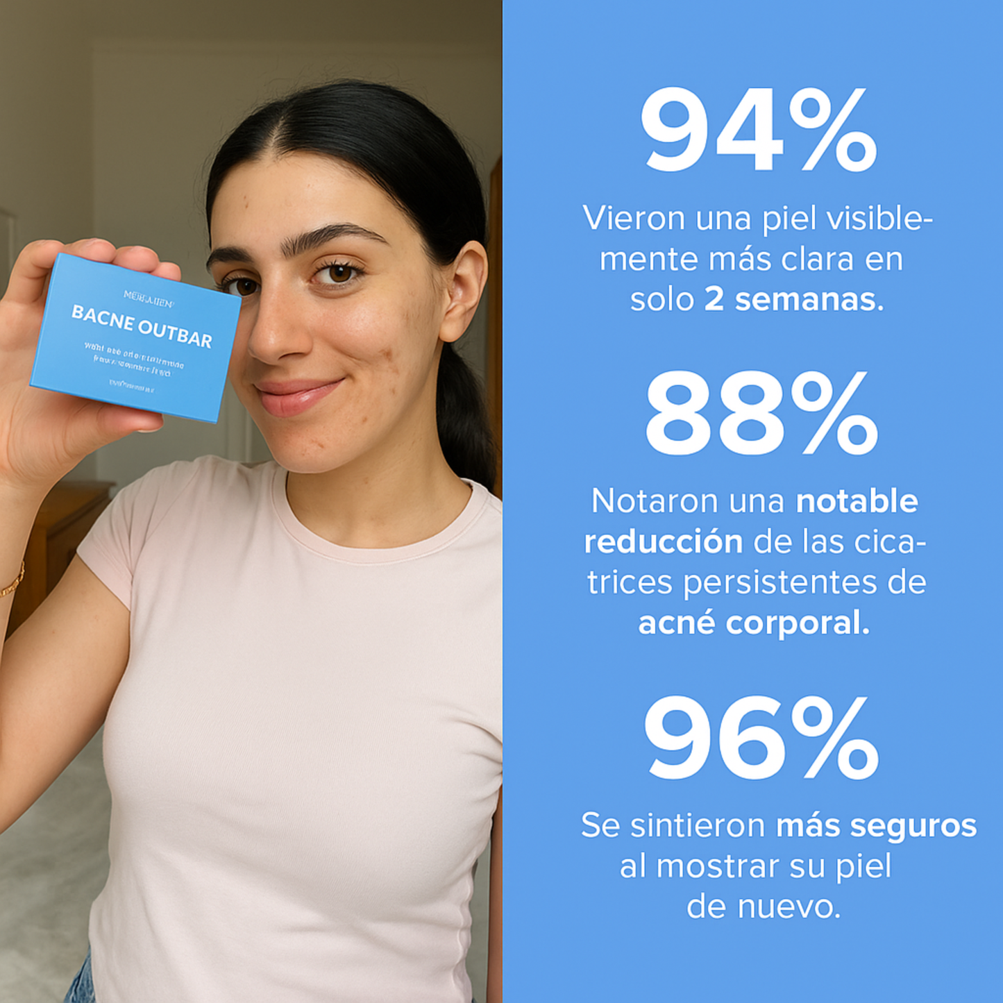 Bacne - Elimina tu acné de la espalda